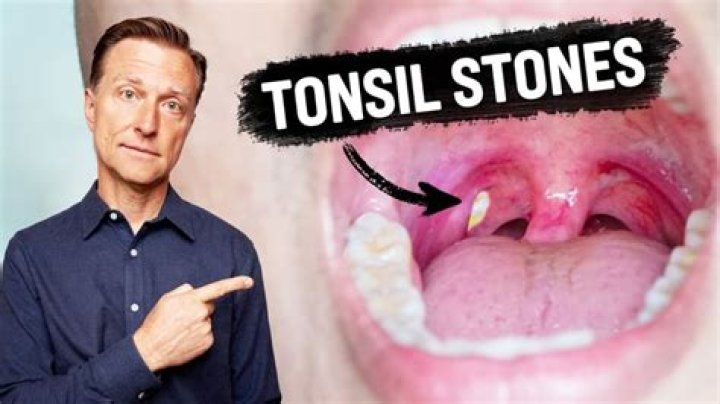 Can bad tonsils make you sick?