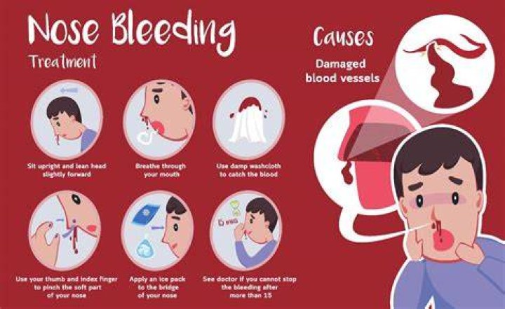 Can being anemic cause nose bleeds?