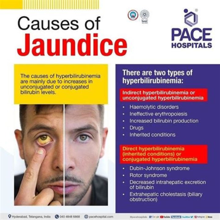 Can gallbladder cause jaundice?