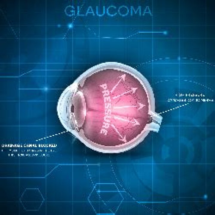 Can glaucoma be stopped?