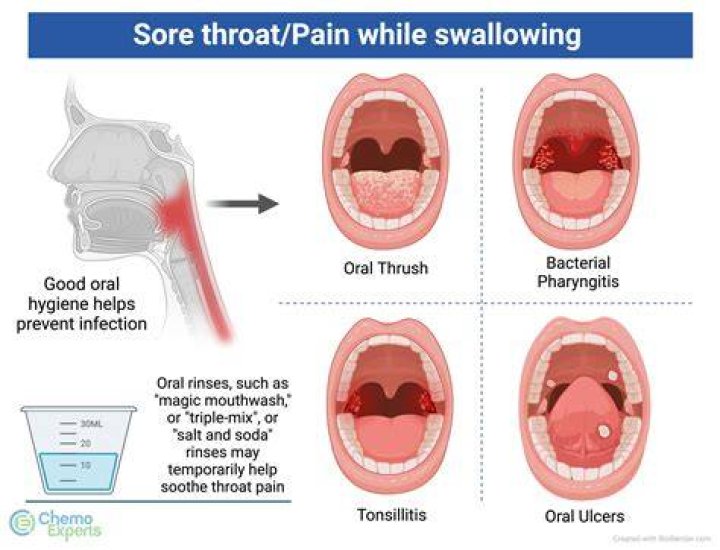 Can Hep A vaccine cause sore throat?