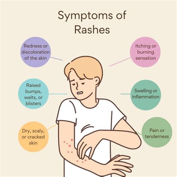 Can Imodium cause skin rash?