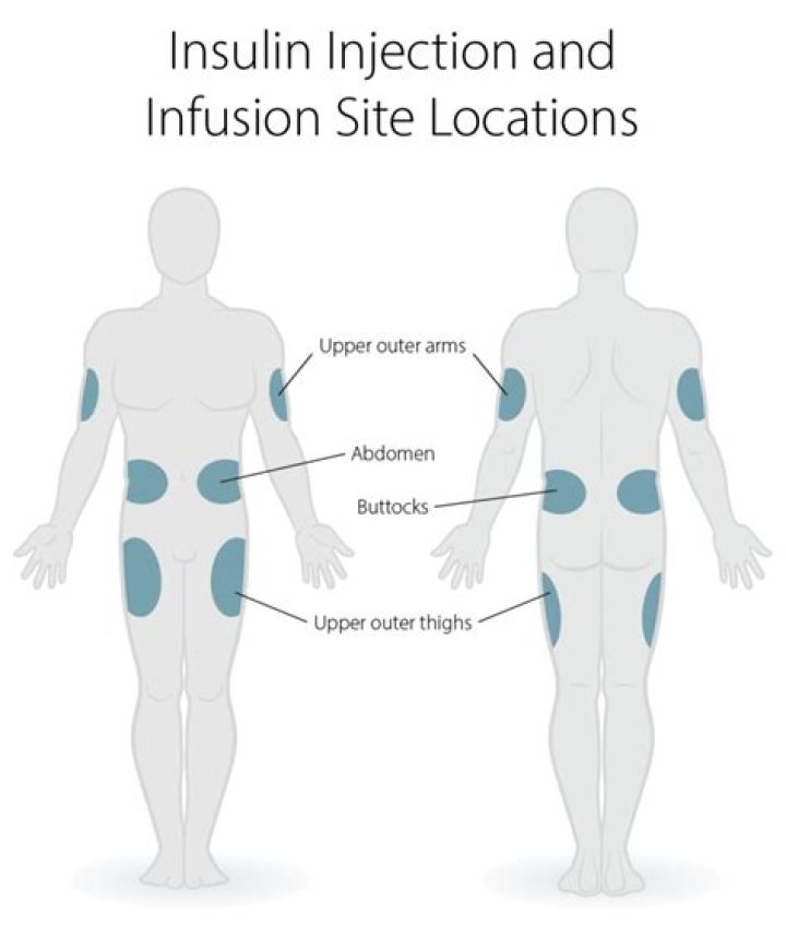 Can insulin injection be given intramuscular?