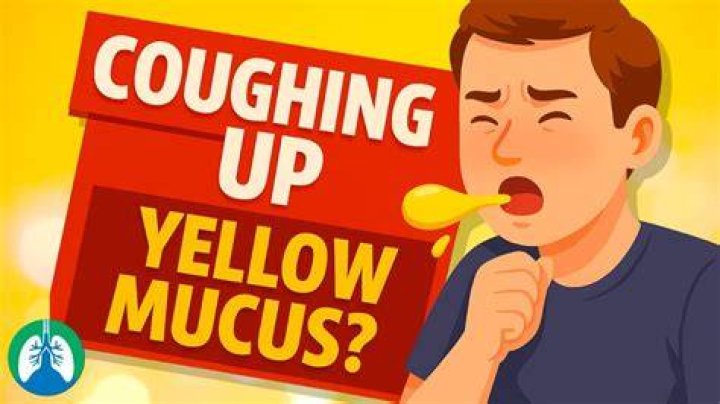 Do I need antibiotics if my phlegm is yellow?