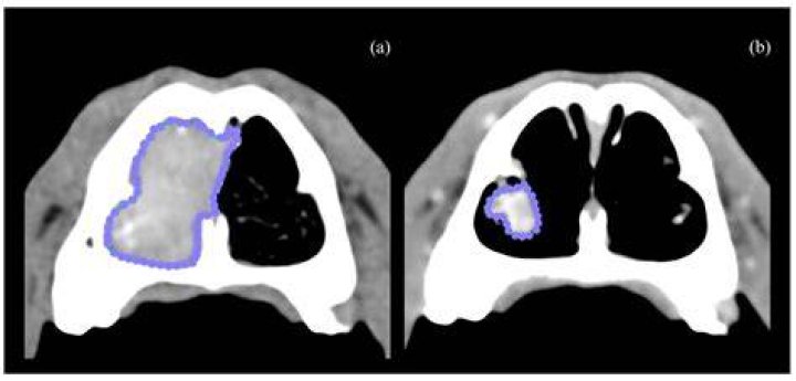 Do nasal tumors hurt?