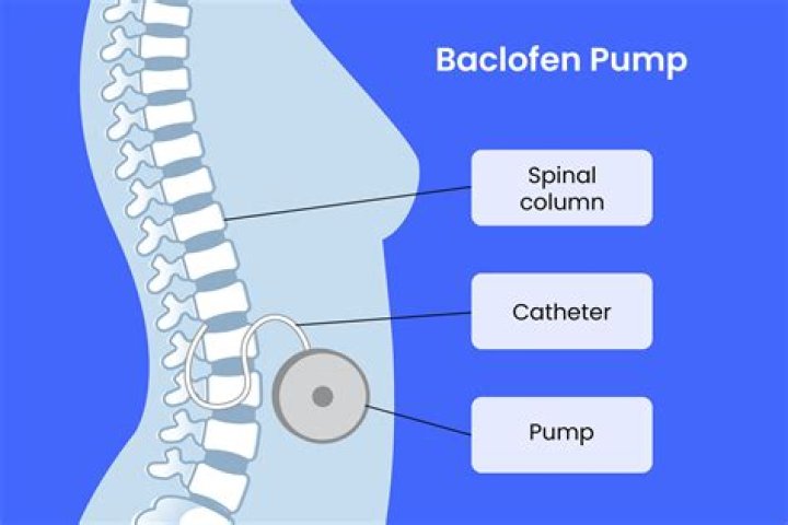 Does baclofen cross the placenta?