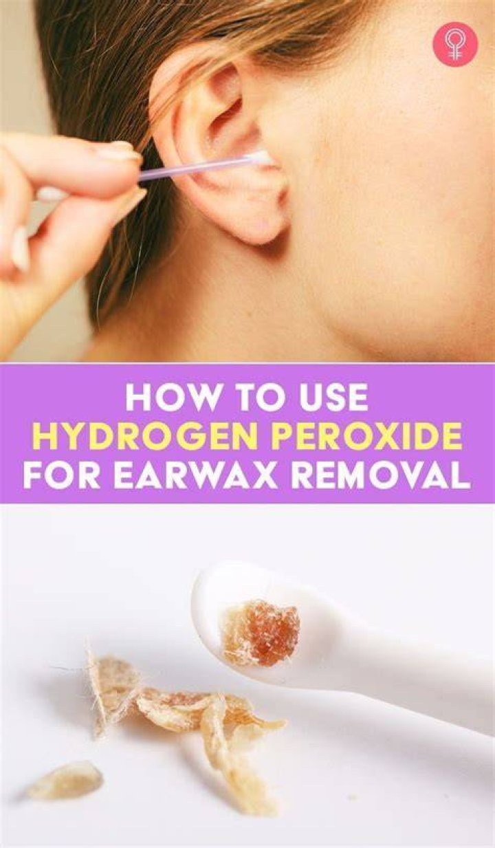 Does hydrogen peroxide remove wax from ears?