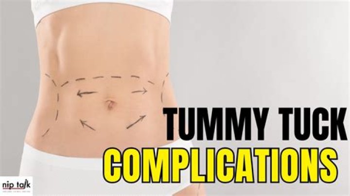 How can you tell if you messed up your tummy tuck?