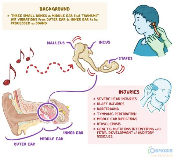 How do I get rid of the pain in my ear?