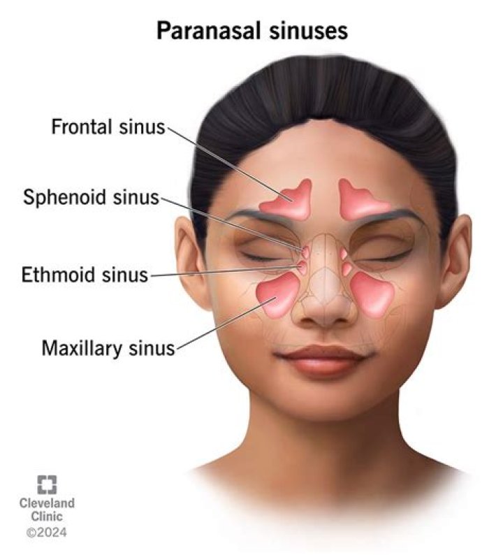 How do paranasal sinuses get infected?