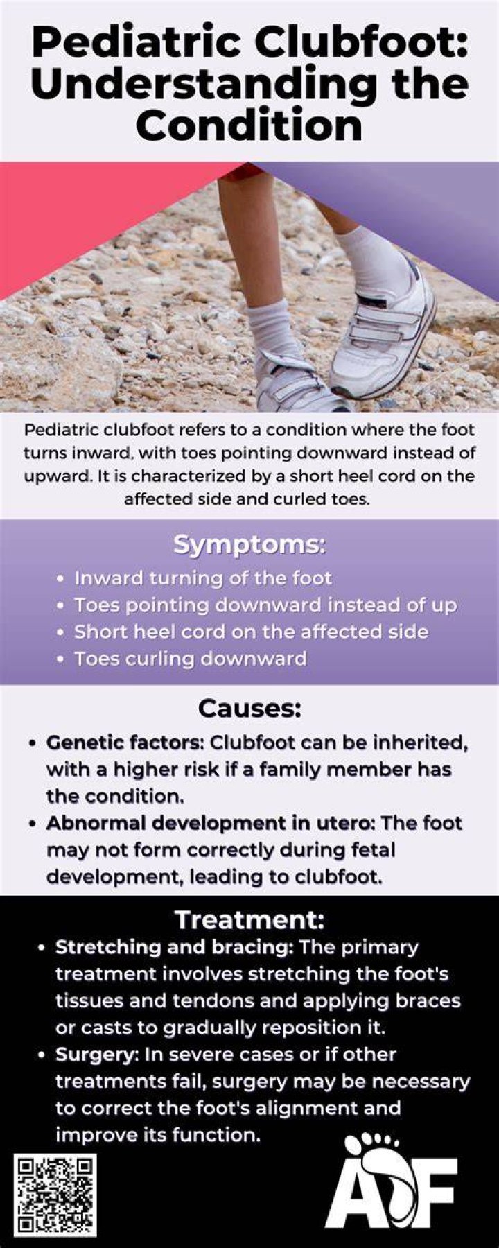 How do you evaluate clubfoot?