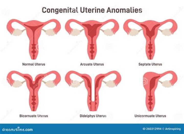 How long after birth can you get a uterine infection?
