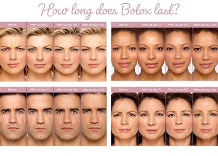 How long does it take to see results with HairMax?