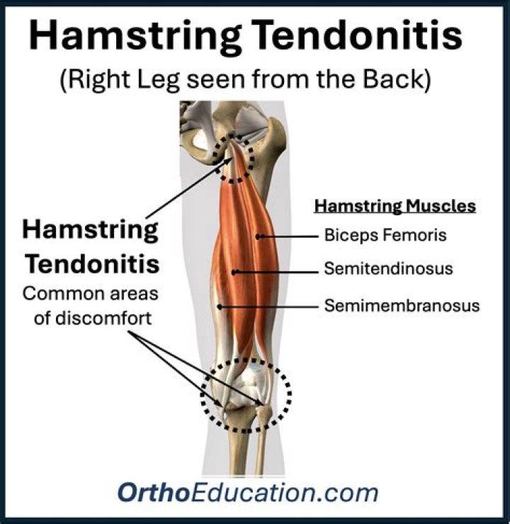 How long does Semimembranosus take to heal?