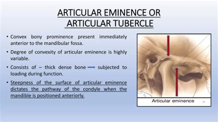 Is articular eminence same as tubercle?
