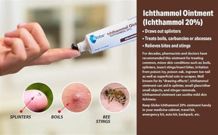 Is Ichthammol ointment good for abscess?