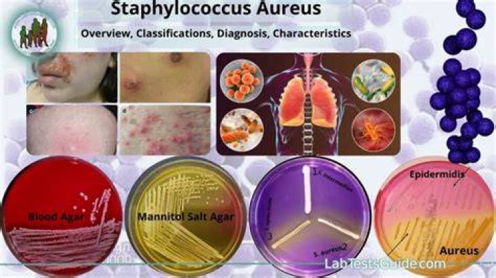 Is Staphylococcus epidermidis resistant to vancomycin?