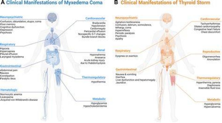 Is thyroid storm the same as myxedema coma?
