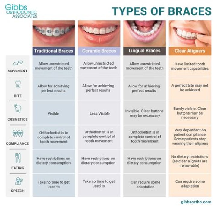 What are the different types of mouthpieces?