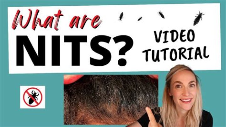 What are the old NITs?