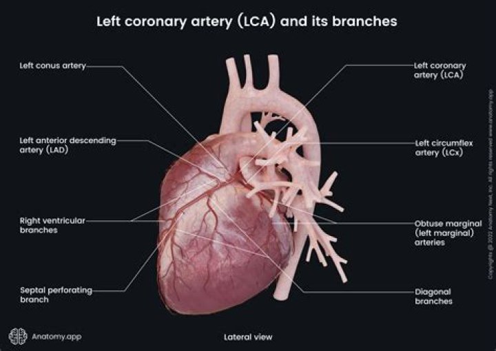 What are the right and left coronary arteries branches of?