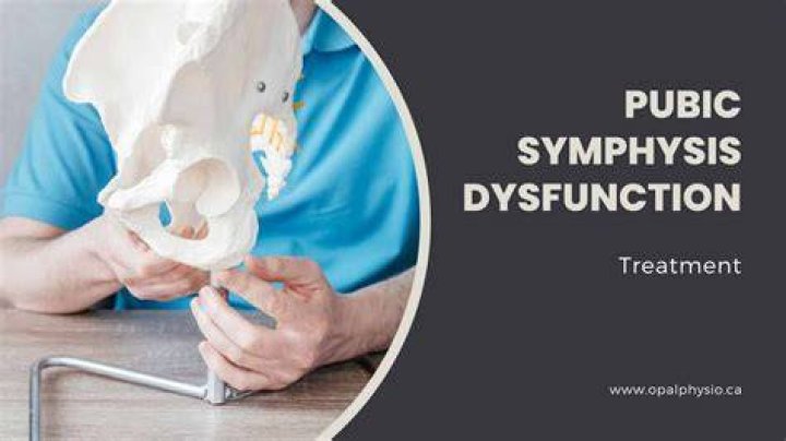 What can be done for symphysis pubis dysfunction?