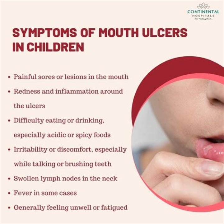 What causes mouth ulcers in a child?