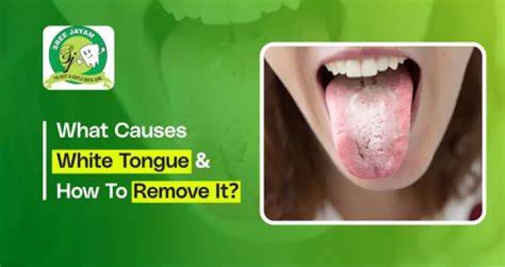 What causes timber tongue?