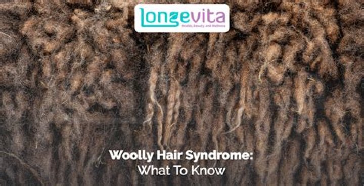 What causes woolly hair syndrome?