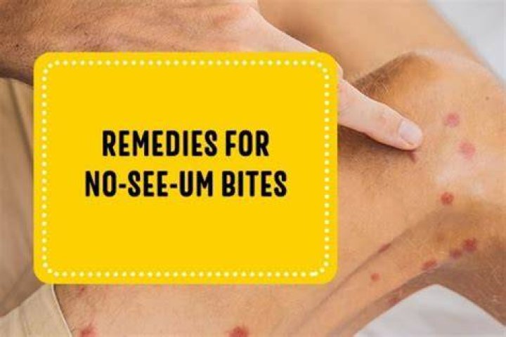What does a bite from a Noseeum look like?