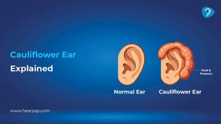 What does having long ears mean?