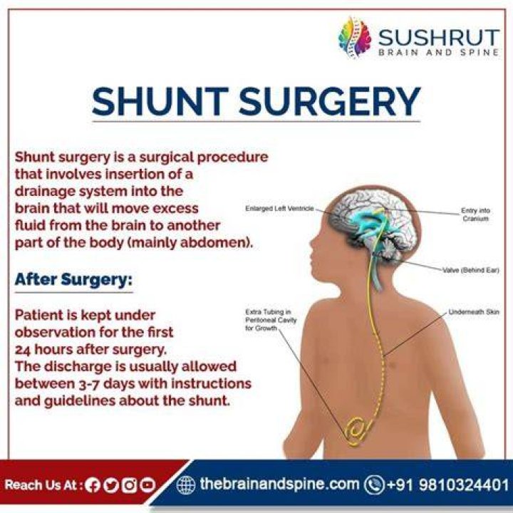 What happens during a shunt revision?
