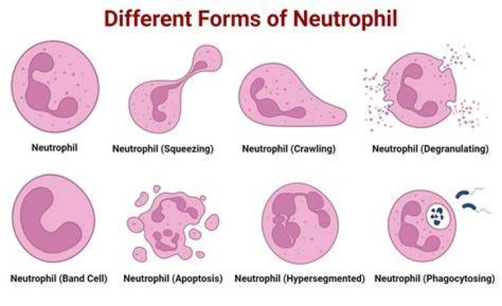 What is a high neutrophil count in children?