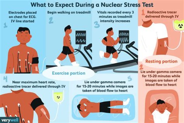 What is a NM stress test?