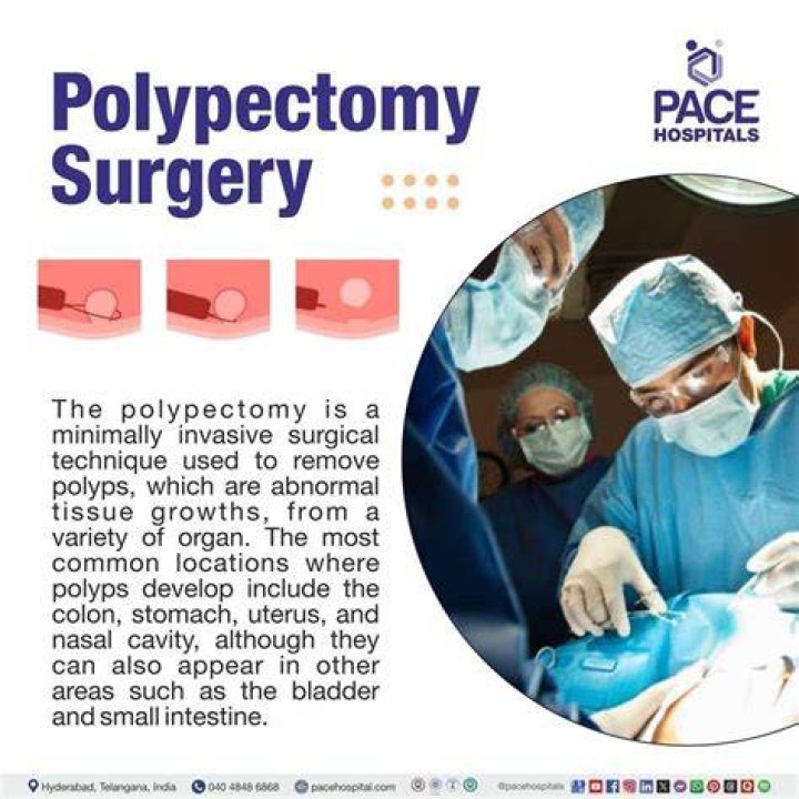 What is a polypectomy in medical terms?