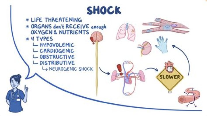 What is non medical shock?