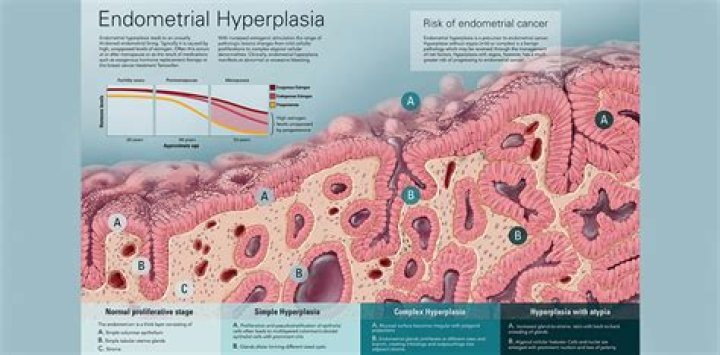 What is the most accurate diagnostic tool for endometrial hyperplasia?