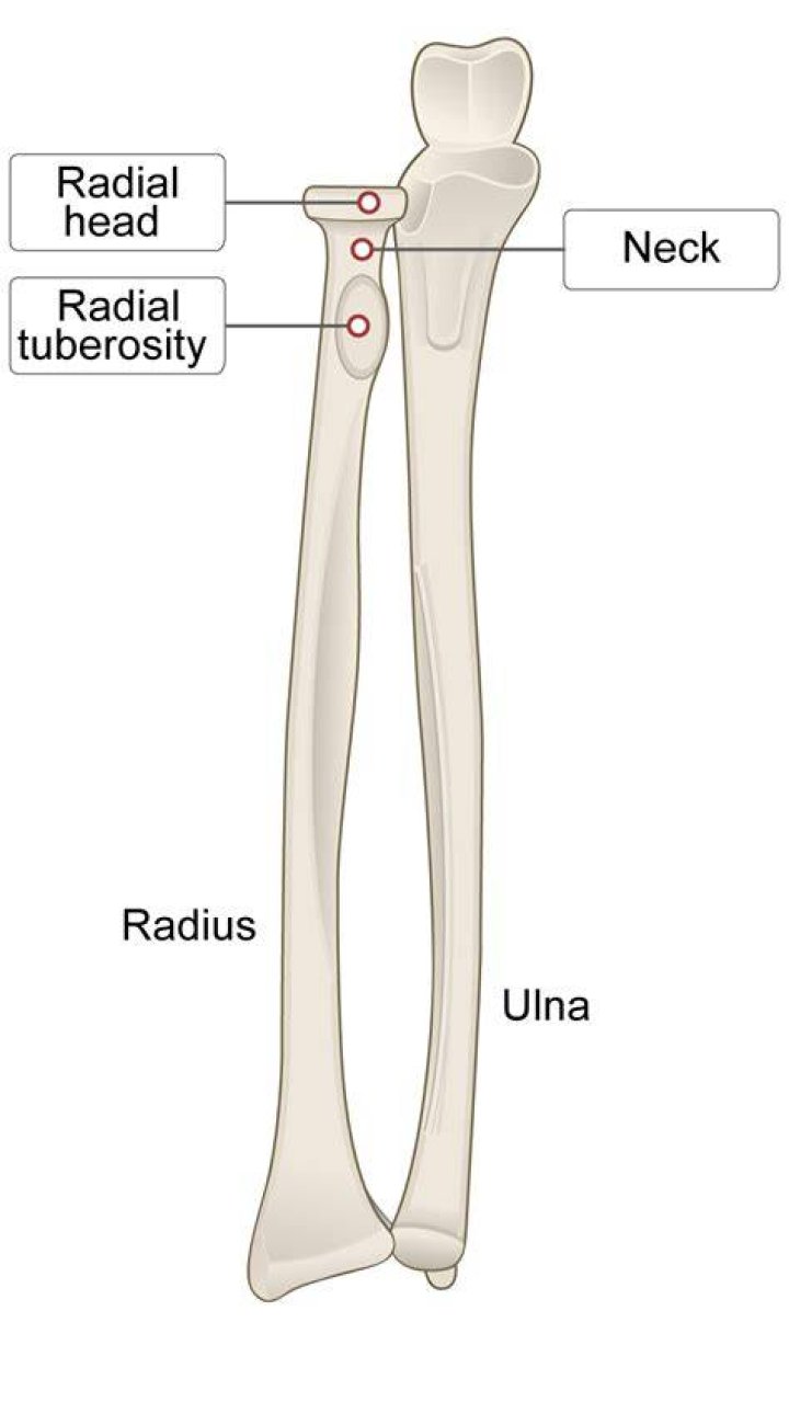 What is the radius one?