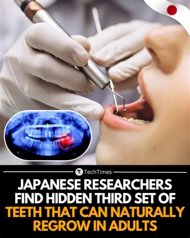 What is the third set of teeth called?