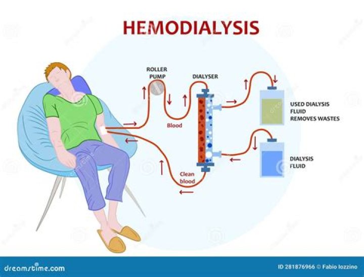 What is WRO in dialysis?