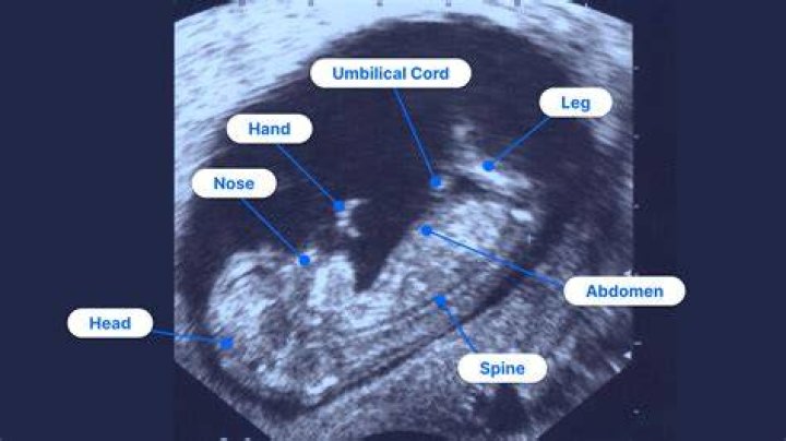 What paper is used to print ultrasounds?