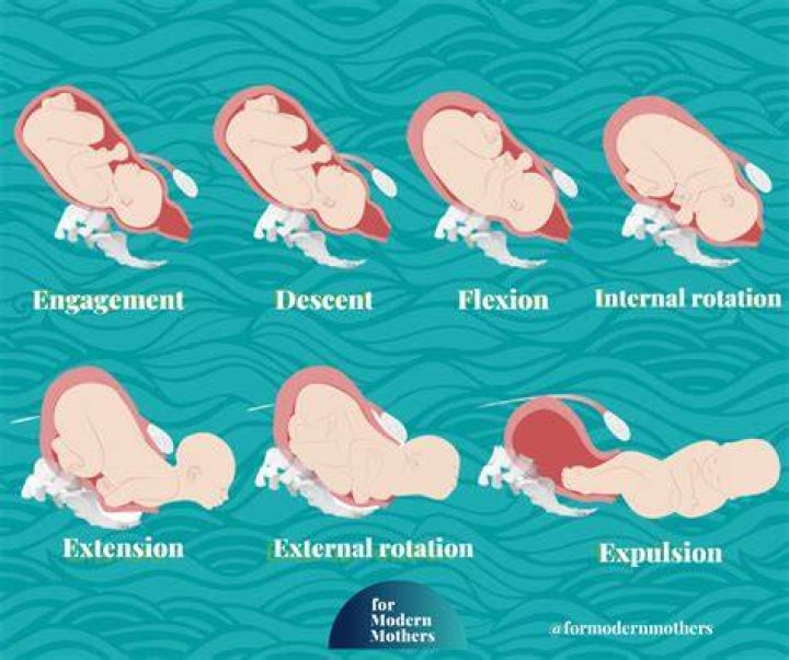 Which baby position is best for normal delivery?