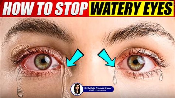 Why do my eyes feel watery with contacts?