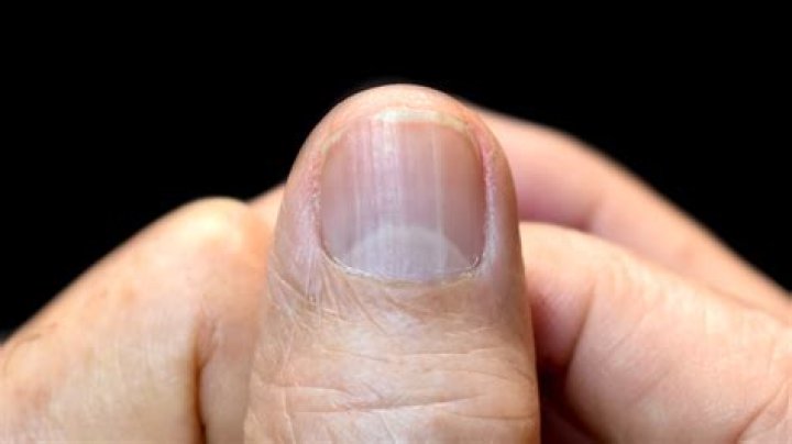 Why is the top of my nail really white?
