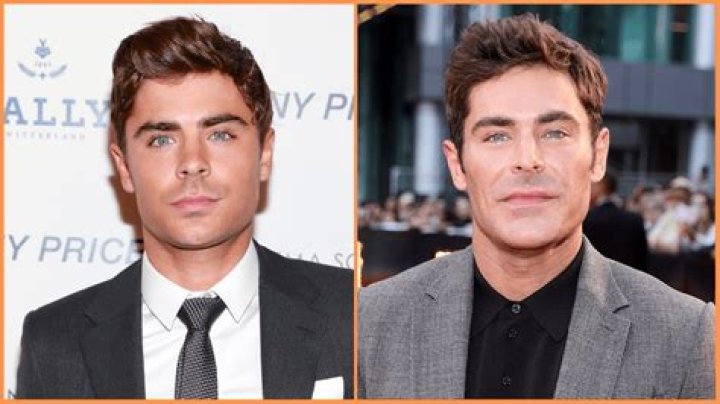 
Zac Efron Face Car Accident? What Happened To Zac Efron? 